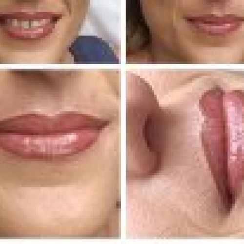 Micropigmentación de labios en Centro de Estética Fusión  en Valladolid