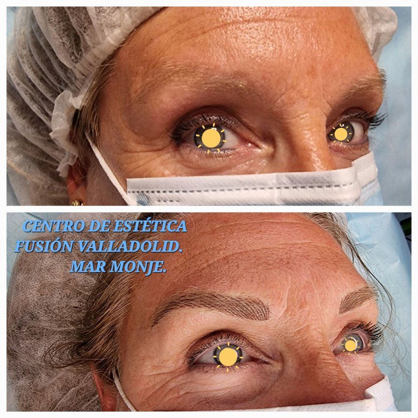 Nanomicropigmentación de cejas en Centro de Estética Fusión