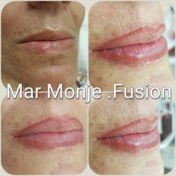 Valladolid micropigmentación