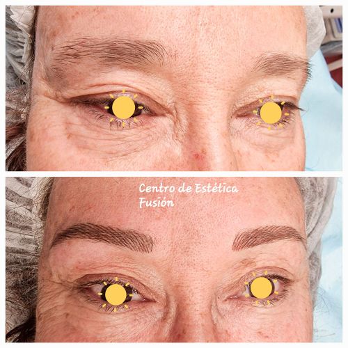 Nanomicropigmentación