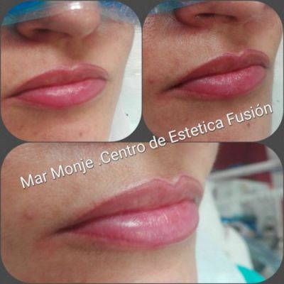 Valladolid micropigmentación