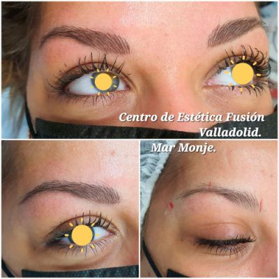 Nanomicropigmentación