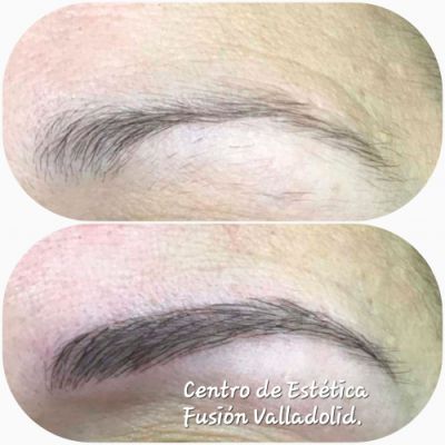 Nanomicropigmentación