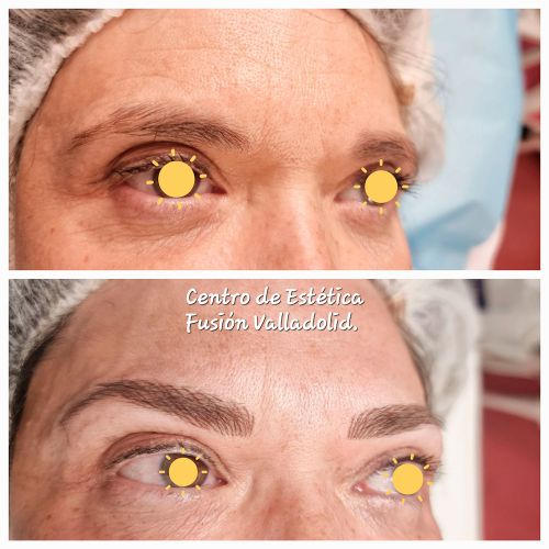 Nanomicropigmentación