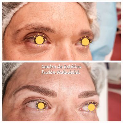 Nanomicropigmentación